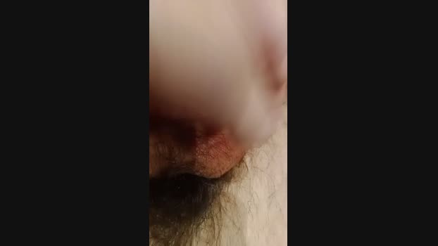 Matheopcs 09-03-2024 Recorded Video gag
