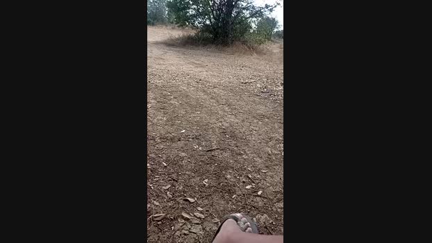 Gastea1 17-08-2024 Recorded Video oral