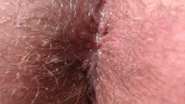 dreamon007 03-08-2025 Recorded Video gag
