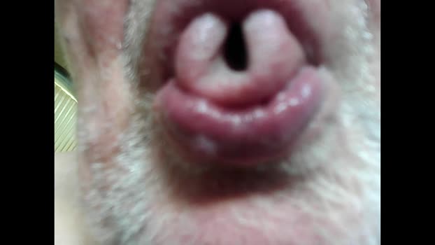 zahnlos 12-12-2025 Recorded Video cute